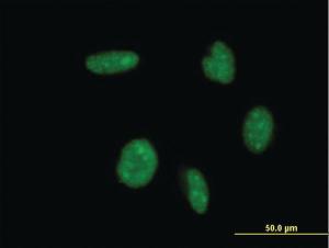 Anti-ATOH1 Mouse Monoclonal Antibody [clone: 4H2]