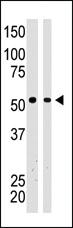 Anti-BAIAP2 Rabbit Polyclonal Antibody