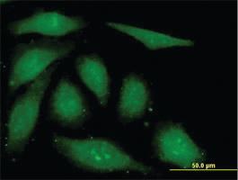 Anti-FGF1 Mouse Monoclonal Antibody [clone: 3F5]