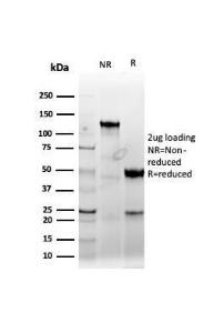 SDS-PAGE analysis of Anti-Cyclin E Antibody [CCNE1/4935R] under non-reduced and reduced conditions; showing intact IgG and intact heavy and light chains, respectively. SDS-PAGE analysis confirms the integrity and purity of the antibody.