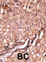 Anti-BAIAP2 Rabbit Polyclonal Antibody