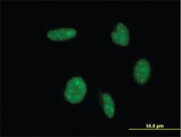 Anti-ATOH1 Mouse Monoclonal Antibody [clone: 4H2]