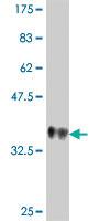 Anti-UNC13B Mouse Polyclonal Antibody