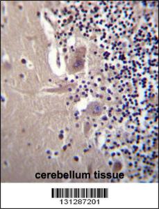 Anti-CRYBA1 Rabbit Polyclonal Antibody (Biotin)