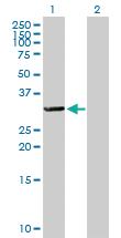 Anti-TTC33 Mouse Polyclonal Antibody