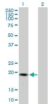 Anti-GREM2 Mouse Polyclonal Antibody