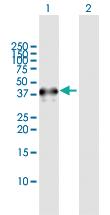 Anti-NEIL2 Rabbit Polyclonal Antibody