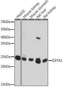 Western blot analysis of extracts of various cell lines, using Anti-GSTA1 Antibody (A306872) at 1:1,000 dilution. The secondary antibody was Goat Anti-Rabbit IgG H&L Antibody (HRP) at 1:10,000 dilution.