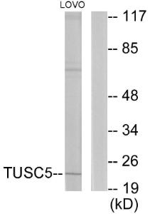 Western blot analysis of lysates from LOVO cells using Anti-TUSC5 Antibody. The right hand lane represents a negative control, where the antibody is blocked by the immunising peptide.