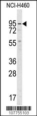 Anti-Guanylyl Cyclase alpha 2 (GUCY1A2) Rabbit Polyclonal Antibody