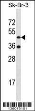 Anti-ETNK2 Rabbit Polyclonal Antibody (AP (Alkaline Phosphatase))