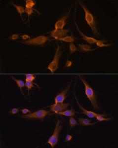 Immunofluorescence analysis of C6 cells using Anti-GSTA1 Antibody (A306872) at a dilution of 1:100 (40x lens). DAPI was used to stain the cell nuclei (blue).