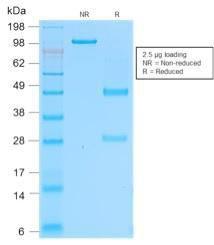 SDS-PAGE analysis of Anti-CD162 Antibody [rPSGL1/1601] under non-reduced and reduced conditions; showing intact IgG and intact heavy and light chains, respectively SDS-PAGE analysis confirms the integrity and purity of the antibody