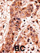 Anti-Guanylyl Cyclase alpha 2 (GUCY1A2) Rabbit Polyclonal Antibody