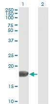 Anti-FGF1 Mouse Monoclonal Antibody [clone: 2E12]