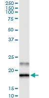 Anti-GREM2 Rabbit Polyclonal Antibody