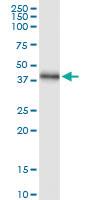 Anti-NEIL2 Rabbit Polyclonal Antibody