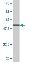 Anti-TPM3 Mouse Monoclonal Antibody [clone: 2E4]