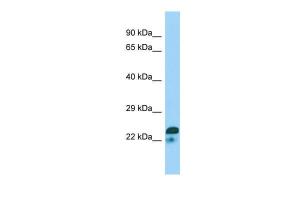 Anti-SPIN2A Rabbit Polyclonal Antibody