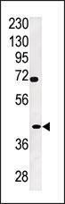 Anti-TPST2 Rabbit Polyclonal Antibody (HRP (Horseradish Peroxidase))