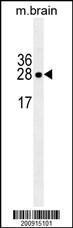 Anti-LXN Mouse Monoclonal Antibody [clone: 199CT6.1.2]