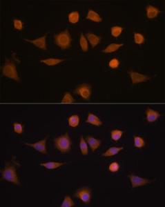 Immunofluorescence analysis of L929 cells using Anti-GSTA1 Antibody (A306872) at a dilution of 1:100 (40x lens). DAPI was used to stain the cell nuclei (blue).