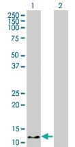 Anti-HBZ Mouse Monoclonal Antibody [clone: 1G10]