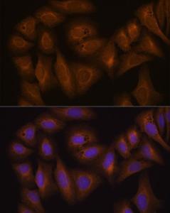 Immunofluorescence analysis of U-2 OS cells using Anti-GSTA1 Antibody (A306872) at a dilution of 1:100 (40x lens). DAPI was used to stain the cell nuclei (blue).