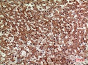 Immunohistochemical analysis of paraffin-embedded human liver using Anti-PTGDR2 Antibody