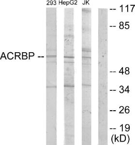 Antibody anti-ACRBP 100 µg