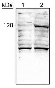 Anti-EPAS1 Mouse monoclonal antibody unconjugated [clone: ep190b]