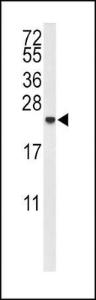 Anti-IL10 Rabbit Polyclonal Antibody (AP (Alkaline Phosphatase))