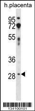 Anti-CD200 Rabbit Polyclonal Antibody (FITC (Fluorescein Isothiocyanate))