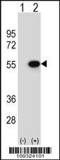 Anti-Reptin Rabbit Polyclonal Antibody (PE (Phycoerythrin))