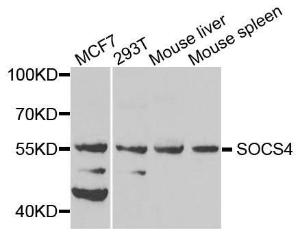 Western blot analysis of extracts of various cell lines, using Anti-SOCS4 Antibody (A8003) at 1:1000 dilution