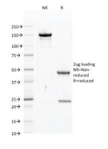 SDS-PAGE analysis of Anti-PU1 Antibody [PU1/2118] under non-reduced and reduced conditions; showing intact IgG and intact heavy and light chains, respectively SDS-PAGE analysis confirms the integrity and purity of the antibody