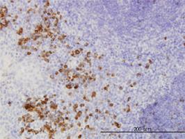 Anti-FGF1 Mouse Monoclonal Antibody [clone: 2E12]