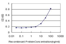 Anti-TTF2 Mouse Monoclonal Antibody [clone: 3D11]