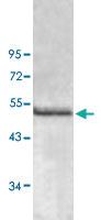 Anti-ACADL Rabbit Polyclonal Antibody