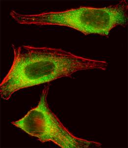 Anti-TEC Rabbit Polyclonal Antibody (AP (Alkaline Phosphatase))