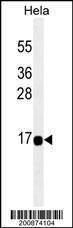 Anti-ACOT13 Mouse Monoclonal Antibody (FITC (Fluorescein Isothiocyanate)) [clone: 169CT7.1.3]