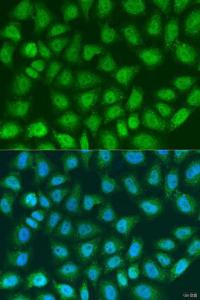 Immunofluorescence analysis of U2OS cells using Anti-SOCS4 Antibody (A8003) at dilution of 1:100. Blue: DAPI for nuclear staining