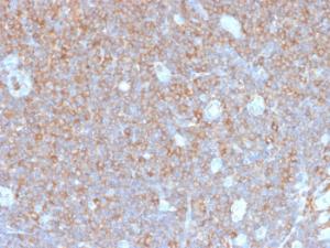 Anti-gamma Parvin Rabbit Recombinant Antibody [clone: PARVG/6312R]