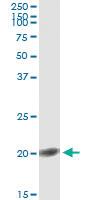 Anti-FGF1 Mouse Monoclonal Antibody [clone: 2E12]