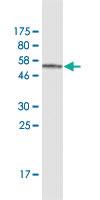 Anti-TPM3 Mouse Monoclonal Antibody [clone: 2E4]