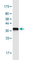 Anti-PLA2G10 Mouse Monoclonal Antibody [clone: 5G11]