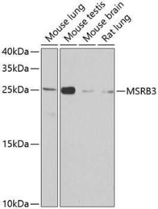 Western blot analysis of extracts of various cell lines, using Anti-MSRB3 Antibody (A12196) at 1:1,000 dilution