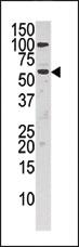 Anti-CHKA Rabbit Polyclonal Antibody