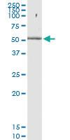 Anti-PHF10 Polyclonal Antibody Pair