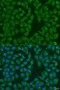 Immunofluorescence analysis of U2OS cells using Anti-MSRB3 Antibody (A12196) at a dilution of 1:100. DAPI was used to stain the cell nuclei (blue)